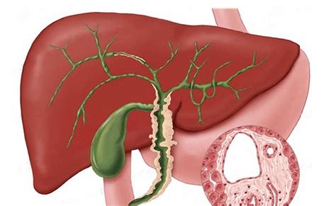 Primary biliary cholangitis